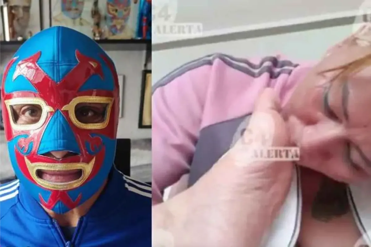 Famous Mexican wrestler accused of forcing his partner to burn with acid